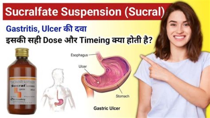 Medicine: U for Ulcers - TIME
