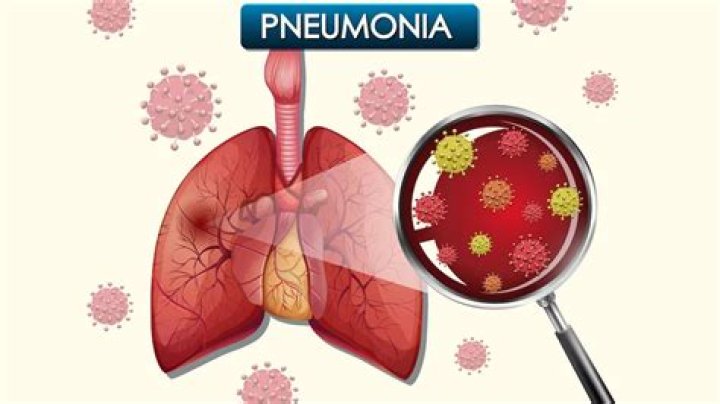 What to Know About the Bacteria Behind the Pneumonia Outbreak in Ohio and China – Healthline